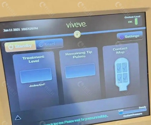  Viveve薇蜜真的管用吗？技术核心解析