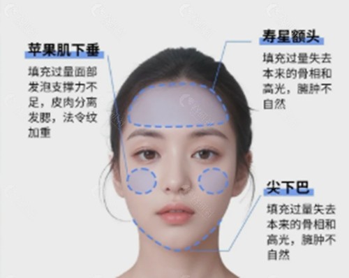 成都友谊馒化脸修复好吗