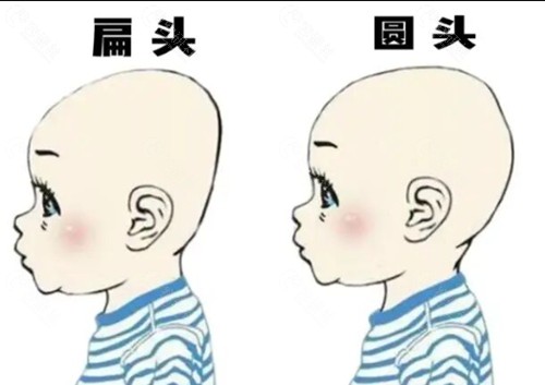 扁头和圆头的区别图片