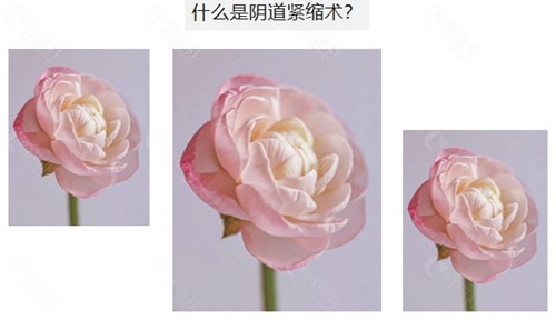 南京医科大学友谊整形外科医院扬州分院做私密手术怎么样