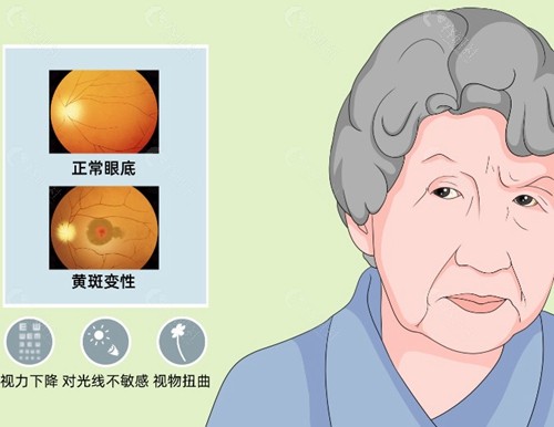 国内视网膜色素变性诊疗医生排名前十