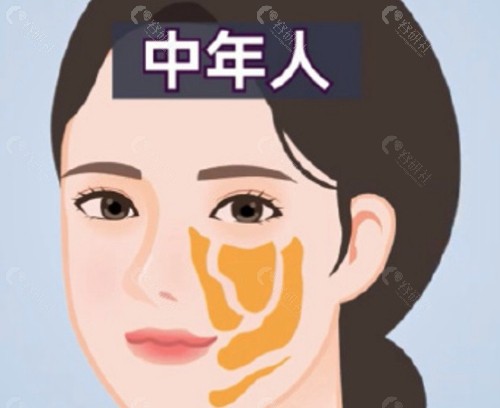 宋连成医生的技术特色