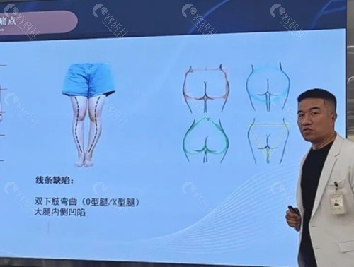 王东吸脂手术好吗