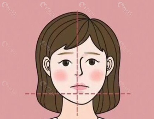 郑广森正颌手术做得怎么样？
