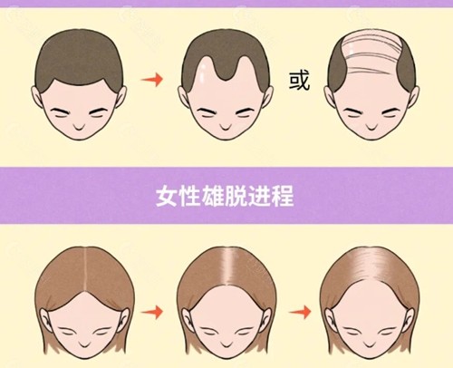 南阳维多利亚植发好吗