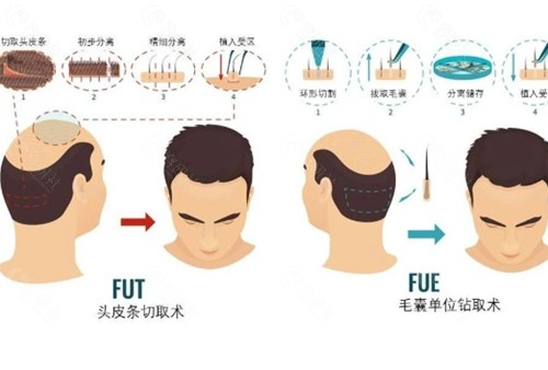 南阳仁康植发好吗