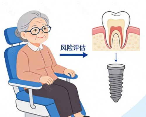 2026年黄盛兴全口种植牙价格参考