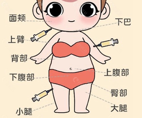 彭涛：FSE分层定点吸脂——“稳健派”的微米级控制