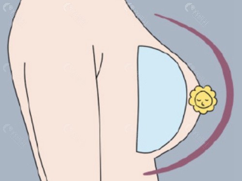 普罗菲耳（Profile）郑在皓院长：隆胸修复的“细节控”