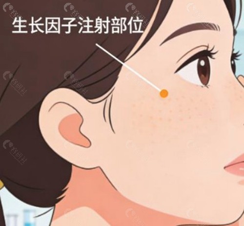 为什么生长因子不能“一抽了之”？