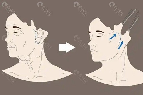穆宝安 vs 黄寅守：满意度差异化分析