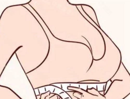 複合式隆胸一般要做幾次手術？