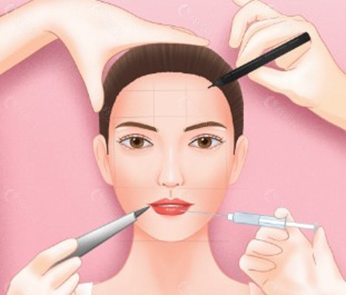 香港美神針注射價格行情（2026年參考）