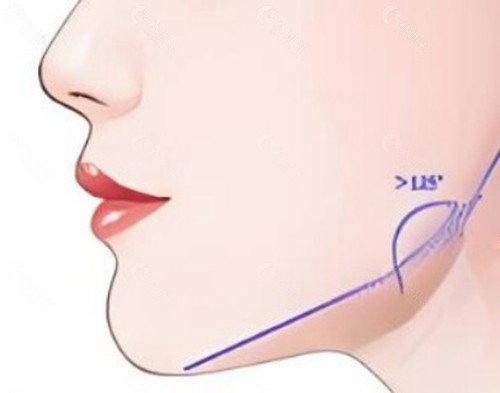 2. 刘正茂：经验丰富的“稳健派”