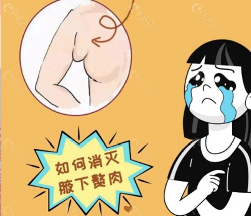 切副乳的手术大概需要多少钱？