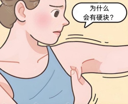 切副乳去医院还是私立整形？