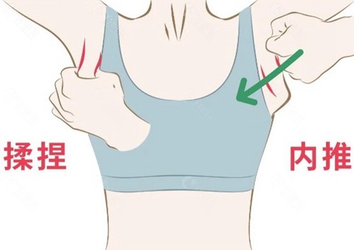 术后要不要住院？