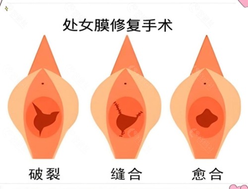 常德曹家医疗美容做私密手术好吗