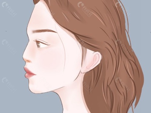  刘喆骐肋软骨隆鼻好还是假体隆鼻好？