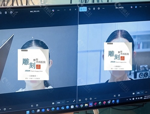 高颅顶美人标准是什么