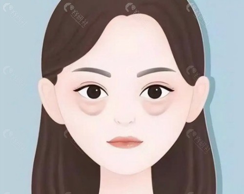 3. 魏志香：专攻眼修复20年，力学支撑防外翻