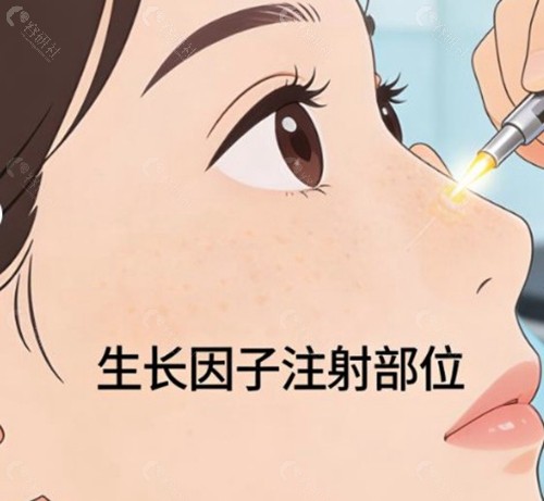 北京取生长因子靠谱的医生及技术特色 北京取生长因子靠谱的医生及技术特色