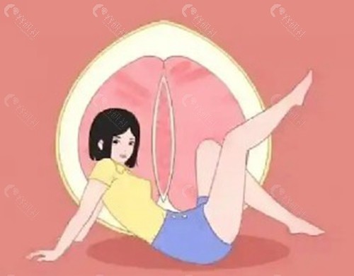 季菲医生做私密整形手术怎么样？