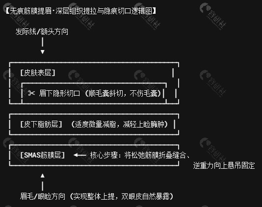 无痕筋膜提眉手术原理示意图