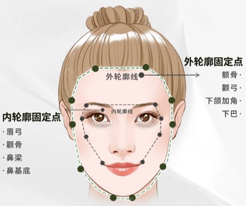 熊哲祯医生的轮廓固定技术靠谱吗? 熊哲祯医生的轮廓固定技术靠谱吗?