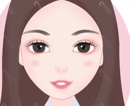 雷义波医生做双眼皮怎么样？