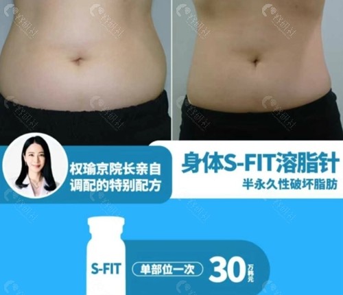 韩国UYOU 皮肤科溶脂好吗 韩国UYOU 皮肤科溶脂好吗