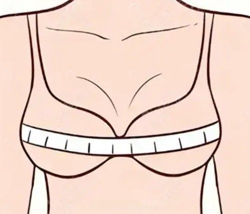 栗勇医生做巨乳缩小手术真的好吗？