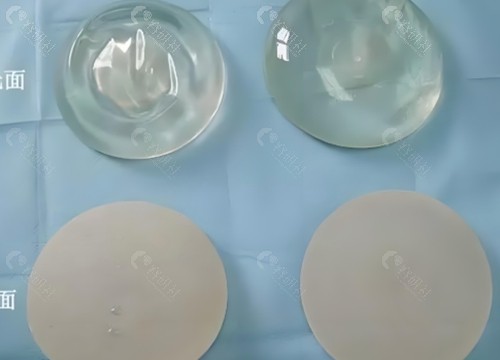 隆胸假体怎么样选择尺寸？