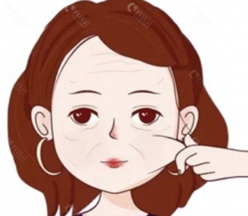 五十多岁改善面部松弛的进阶方案 五十多岁改善面部松弛的进阶方案