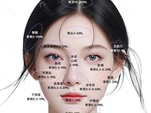 杨镁施医生玻尿酸注射技术好吗 杨镁施医生玻尿酸注射技术好吗