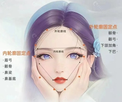 何梦媛轮廓固定是打玻尿酸吗?材料如何选型? 何梦媛轮廓固定是打玻尿酸吗?材料如何选型?