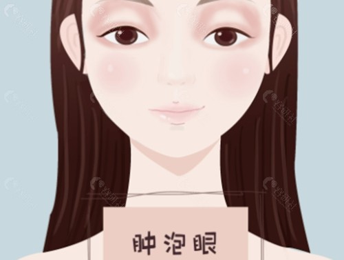 为什么肿泡眼“去皮去脂”了依然臃肿？