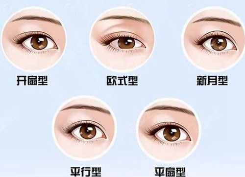 胡小清医生的仿生双眼皮是真的吗？