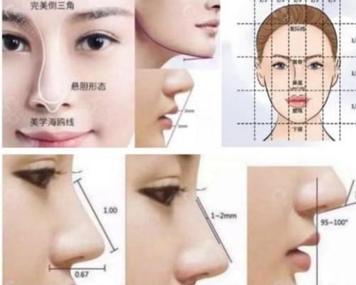 大同景然医疗美容隆鼻好吗