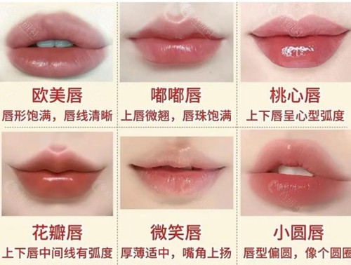 张小芸唇部整形好吗