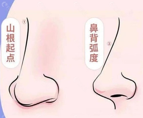 什么是“鼻尖四角支撑”技术？