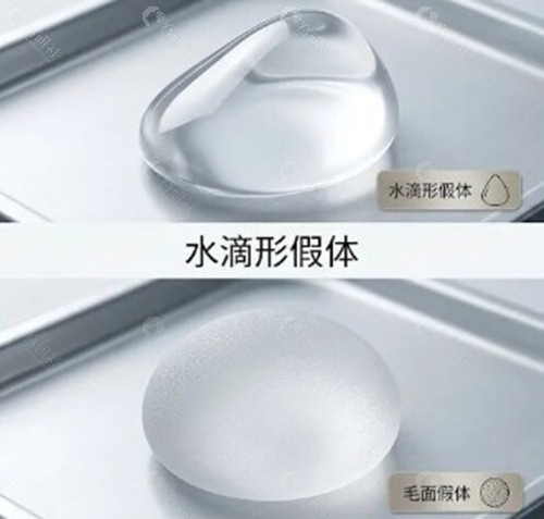  假体隆胸术后手感变化的医学“时间轴”