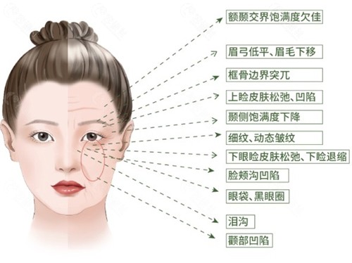 香港陳靖邦醫生做玻尿酸輪廓固定的技術特色與審美標籤 香港陳靖邦醫生做玻尿酸輪廓固定的技術特色與審美標籤