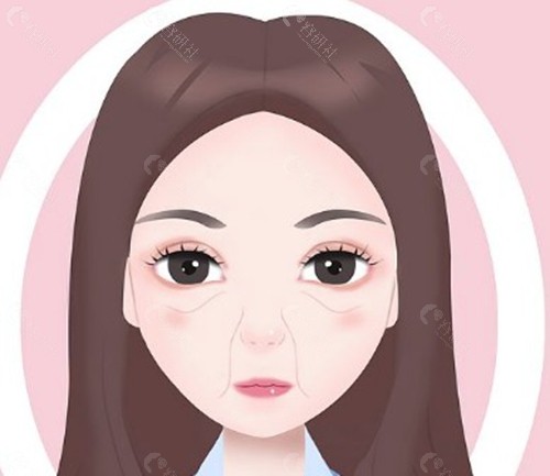 韩国面部提升埋线可选的主流线材有哪些？