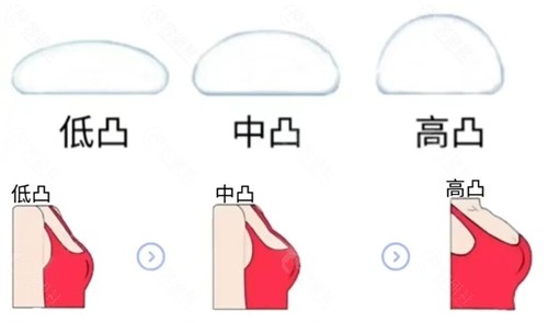 隆胸高凸看起来会很假吗? 隆胸高凸看起来会很假吗?