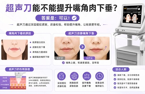 超声刀哦啊能不能提升嘴角肉下垂