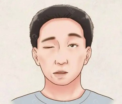 韩国四大眼提肌名院技术特色解构