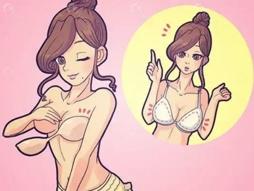 黄和平医生胸部下垂矫正做得好吗？