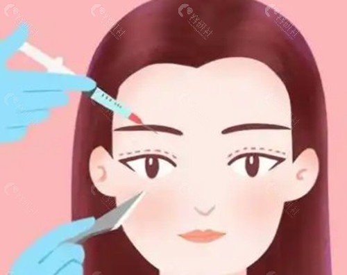 濡白天使打眉弓好还是少女针好