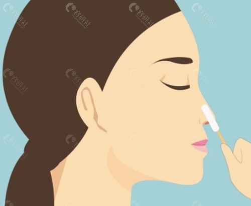 杨红华做鼻子的核心手术优势